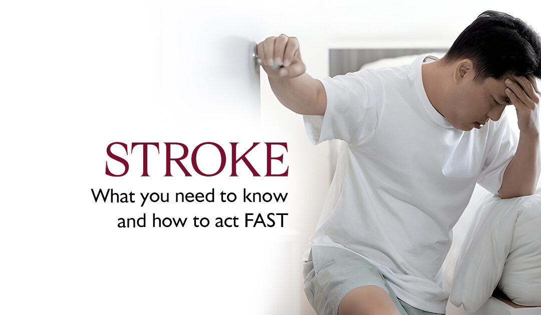 Stroke: What You Need to Know and How to Act Fast