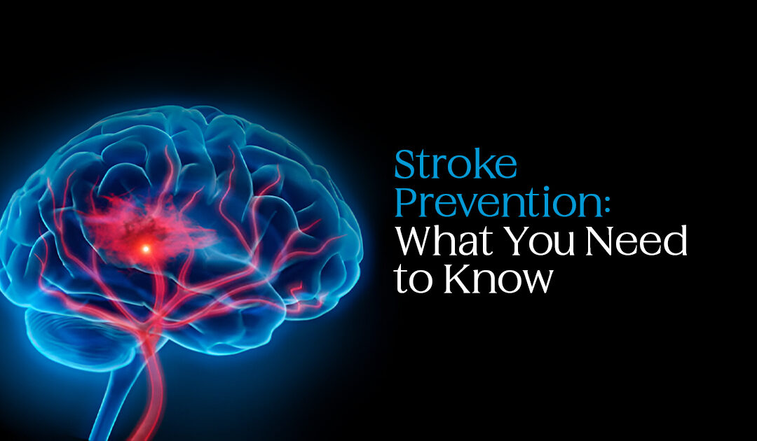 Brain Stroke